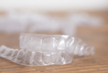 Invisalign Alternatives